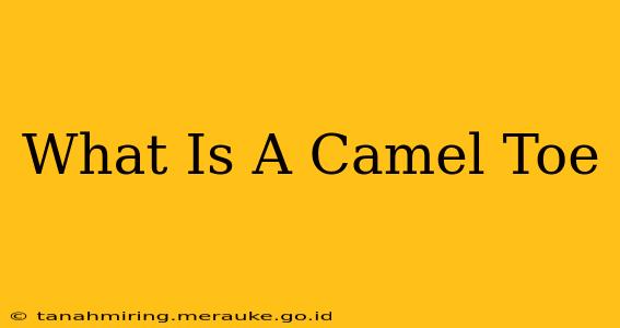 What Is A Camel Toe